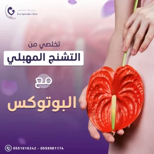 حقن البوتكس للتشنج المهبلي