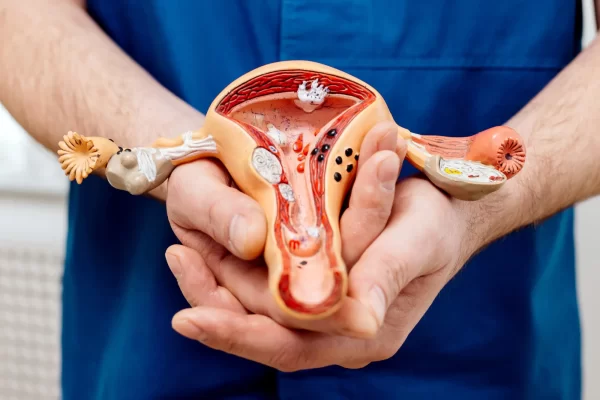 إستئصال لحمية من الرحم